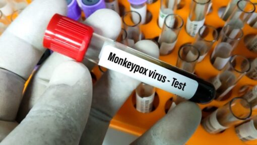 Govt declares high alert against Monkey Pox in Pakistan