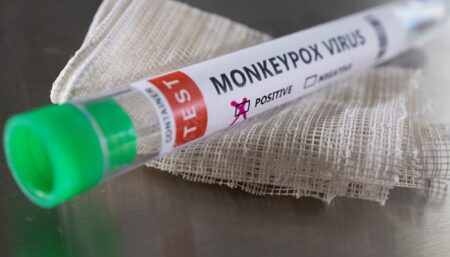 First Case of Monkeypox in Pakistan Confirmed Monkeypox in Pakistan