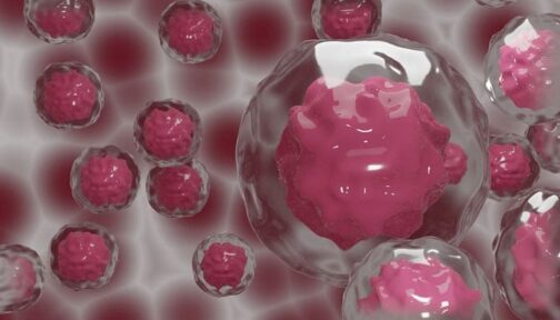 Warning Signs of Cancer: Identifying Life-Threatening Symptoms for Early Detection Warning Signs of Cancer: Identifying Life-Threatening Symptoms for Early Detection